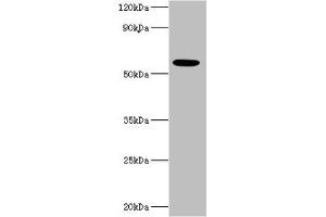 Western blot All lanes: IFNAR2 antibody at 10 μg/mL + MCF-7 whole cell lysate Secondary Goat polyclonal to rabbit IgG at 1/10000 dilution Predicted band size: 58, 38, 28 kDa Observed band size: 58 kDa