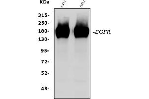 Western blot analysis of EGFR using anti-EGFR antibody (ABIN5518909). (EGFR anticorps  (N-Term))