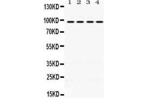 Western Blotting (WB) image for anti-Programmed Cell Death 6 Interacting Protein (PDCD6IP) (AA 2-330) antibody (ABIN3043596) (ALIX anticorps  (AA 2-330))