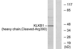 Western blot analysis of extracts from HeLa cells, using KLKB1 (heavy chain, Cleaved-Arg390) antibody. (KLKB1 anticorps  (Cleaved-Arg390))
