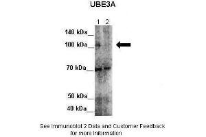 Lanes:   Lane 1: 7ug HeLa lysate+EGFP SiRNA  Lane 2: 7ug HeLa lysate+UBE3A SiRNA  Primary Antibody Dilution:   1:300  Secondary Antibody:   Anti-rabbit-HRP  Secondary Antibody Dilution:   1:500  Gene Name:   UBE3A  Submitted by:   Seiji Masuda, Kitashirakawa Oiwakecho, Kyoto University