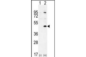 Western blot analysis of TGIF1 (arrow) using rabbit polyclonal TGIF1 Antibody (Center ) (ABIN655999 and ABIN2845378). (TGIF1 anticorps  (AA 208-237))