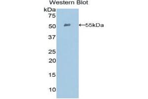 Western blot analysis of the recombinant protein. (EFNA4 anticorps  (AA 1-204))