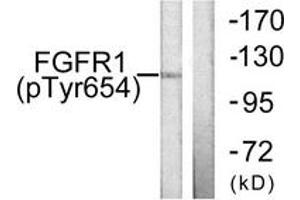 Western blot analysis of extracts from 293 cells treated with Insulin 0. (FGFR1 anticorps  (pTyr654))