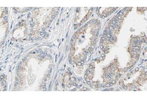 ABIN6276614 at 1/100 staining Human prostate tissue by IHC-P.