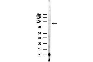 anti-GRAM Domain Containing 1B (GRAMD1B) antibody