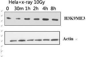 Western Blot (WB) analysis: Please contact us for more details. (Histone 3 anticorps  (H3K9me3))