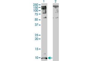 Western Blot analysis of CXCL5 expression in transfected 293T cell line by CXCL5 monoclonal antibody (M05A), clone 2A9. (CXCL5 anticorps  (AA 1-114))