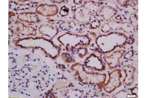 Formalin-fixed and paraffin embedded human kidney labeled with Anti-ATG101 Polyclonal Antibody, Unconjugated  at 1:300 followed by conjugation to the secondary antibody and DAB staining. (ATG101 anticorps  (AA 121-218))