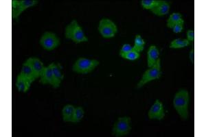 Immunofluorescence staining of HepG2 cells with ABIN7174068 at 1:166, counter-stained with DAPI.