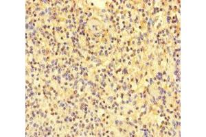 Immunohistochemistry of paraffin-embedded human spleen tissue using ABIN7172088 at dilution of 1:100