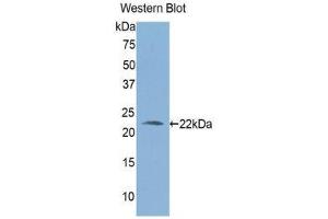 Western Blotting (WB) image for anti-Aldehyde Dehydrogenase 1 Family, Member A3 (ALDH1A3) (AA 332-509) antibody (ABIN1176368) (ALDH1A3 anticorps  (AA 332-509))