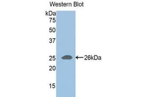 Western blot analysis of the recombinant protein. (ADAMTS1 anticorps  (AA 258-467))
