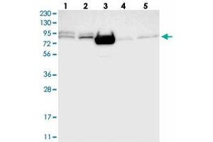 Western blot analysis of Lane 1: RT-4, Lane 2: U-251 MG, Lane 3: Human Plasma, Lane 4: Liver, Lane 5: Tonsil with FOXK1 polyclonal antibody  at 1:250-1:500 dilution.