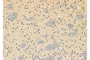 ABIN6261295 and ABIN6273110 at 1/100 staining Mouse brain tissue by IHC-P. (DHX9 anticorps  (C-Term))