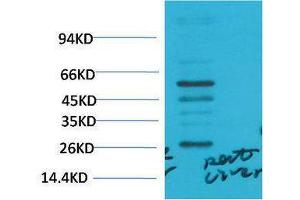Western Blotting (WB) image for anti-Transforming Growth Factor, beta 1 (TGFB1) antibody (ABIN3181581) (TGFB1 anticorps)