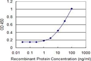 Detection limit for recombinant GST tagged MTMR1 is 0.