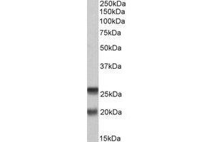 Western Blotting (WB) image for anti-Synaptosomal-Associated Protein, 23kDa (SNAP23) (C-Term) antibody (ABIN2464710) (SNAP23 anticorps  (C-Term))