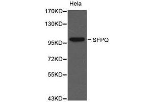 Western Blotting (WB) image for anti-Splicing Factor Proline/glutamine-Ric (SFPQ) antibody (ABIN1874752) (SFPQ anticorps)
