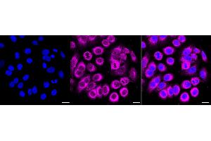 Immunocytochemical staining of HepG2 cells with Collagen type III alpha 1 chain antibody (ABIN7798126), 1:1,000).