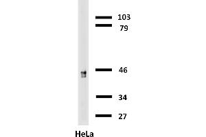 Western blotting analysis of human cytokeratin 18 using mouse monoclonal antibody C-04 on lysates of HT-29 cell line and MOLT-4 cell line (cytokeratin non-expressing cell line, negative control) under non-reducing and reducing conditions.