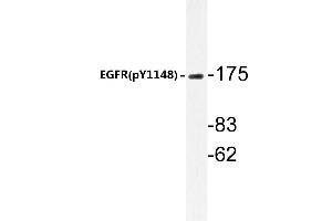 Western blot (WB) analyzes of p-EGFR antibody in extracts from HepG2 cells. (EGFR anticorps  (pTyr1172))