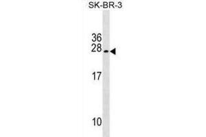 Western Blotting (WB) image for anti-Tumor Suppressor Candidate 5 (TUSC5) antibody (ABIN2999811) (TUSC5 anticorps)