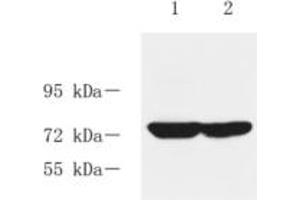 Western blot analysis of RASGRP3 (ABIN7075376) at dilution of 1: 1000,Lane 1:Rat liver tissue lysate,Lane 2: Rat kidney tissue lysate
