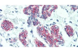 Immunohistochemistry of paraffin-embedded Breast tissue using DSG2 Polyclonal Antibody at dilution of 1:60. (Desmoglein 2 anticorps)