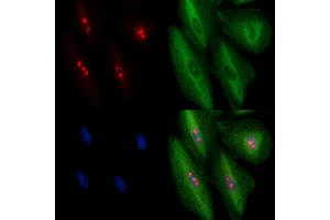 ABIN6263450 and ABIN6278413 staining  cells by IF/ICC. (MYBBP1A anticorps  (C-Term))