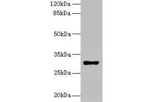 Western blot All lanes: HLA-DRB4 antibody at 2 μg/mL + Raji whole cell lysate Secondary Goat polyclonal to rabbit IgG at 1/10000 dilution Predicted band size: 30 kDa Observed band size: 30 kDa (HLA-DRB4 anticorps  (AA 30-227))