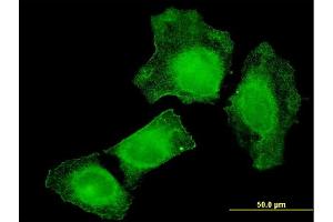 Immunofluorescence of monoclonal antibody to TIAM2 on HeLa cell.
