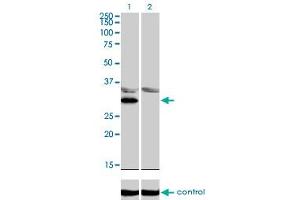Western blot analysis of LDB3 over-expressed 293 cell line, cotransfected with LDB3 Validated Chimera RNAi (Lane 2) or non-transfected control (Lane 1). (LIM Domain Binding 3 Protein anticorps  (AA 1-283))