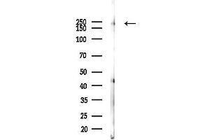 anti-Abelson Murine Leukemia Viral Oncogene Homolog 1/2 (ABL1/ABL2) (pTyr393), (pTyr439) antibody