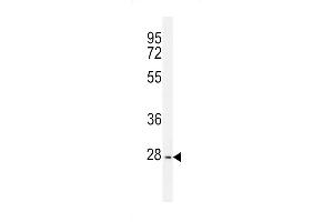 PTPN20A Antibody (Center) (ABIN655743 and ABIN2845189) western blot analysis in K562 cell line lysates (35 μg/lane).