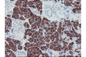 Image no. 1 for anti-Carboxypeptidase A2 (Pancreatic) (CPA2) antibody (ABIN1497595)