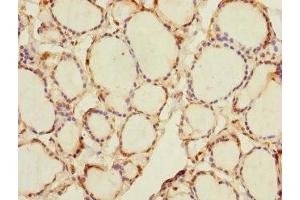 Immunohistochemistry of paraffin-embedded human thyroid tissue using ABIN7168008 at dilution of 1:100 (RHOBTB1 anticorps  (AA 240-400))