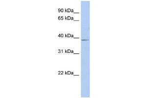 WB Suggested Anti-SLC25A28 Antibody Titration:  0. (SLC25A28 anticorps  (Middle Region))