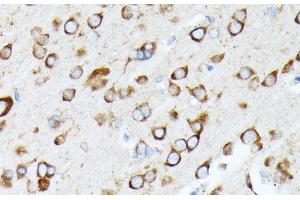 Immunohistochemistry of paraffin-embedded Rat brain using RPL7 Polyclonal Antibody at dilution of 1:100 (40x lens). (RPL7 anticorps)