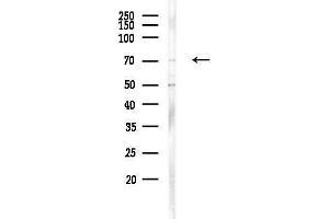 anti-Zinc Finger Protein 337 (ZNF337) antibody