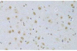 Immunohistochemistry of paraffin-embedded Rat brain using CDKN1A Polyclonal Antibody at dilution of 1:100 (40x lens). (p21 anticorps)
