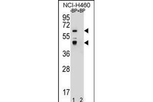 Western blot analysis of PREF3 Antibody (C-term) Pab (ABIN656587 and ABIN2845849) pre-incubated without(lane 1) and with(lane 2) blocking peptide in NCI- cell line lysate. (PRAMEF3 anticorps  (C-Term))