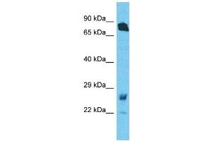 Host:  Rabbit  Target Name:  RHOT1  Sample Type:  Fetal Lung lysates  Antibody Dilution:  1.