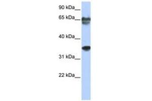 Image no. 1 for anti-NK3 Homeobox 2 (NKX3-2) (N-Term) antibody (ABIN6740332) (NKX3-2 anticorps  (N-Term))