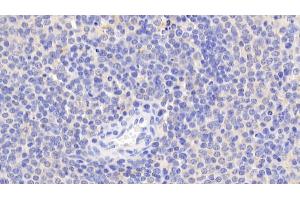 Detection of Bid in Human Spleen Tissue using Polyclonal Antibody to BH3 Interacting Domain Death Agonist (Bid) (BID anticorps  (AA 1-195))