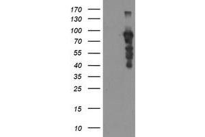 Western Blotting (WB) image for anti-SRY (Sex Determining Region Y)-Box 5 (SOX5) antibody (ABIN1501083) (SOX5 anticorps)
