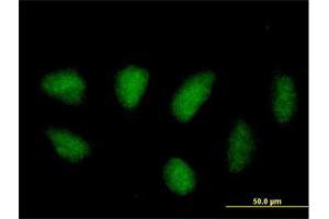 Immunofluorescence of purified MaxPab antibody to MAPK11 on HeLa cell.