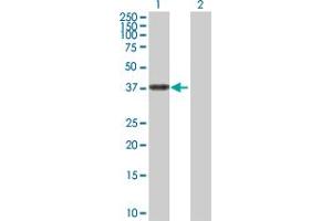 Western Blot analysis of ALDH3B2 expression in transfected 293T cell line by ALDH3B2 MaxPab polyclonal antibody. (ALDH3B2 anticorps  (AA 1-385))
