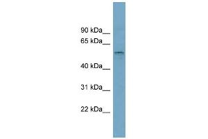 WB Suggested Anti-SLC22A15 Antibody Titration:  0. (SLC22A15 anticorps  (Middle Region))