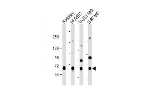 All lanes : Anti-NOX4 Antibody (N-term) at 1:2000 dilution Lane 1: Human kidney lysate Lane 2: HUVEC whole cell lysate Lane 3: U-251 MG whole cell lysate Lane 4: U-87 MG whole cell lysate Lysates/proteins at 20 μg per lane. (NADPH Oxidase 4 anticorps  (N-Term))